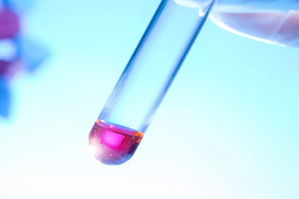 VIB.BE - PID Results