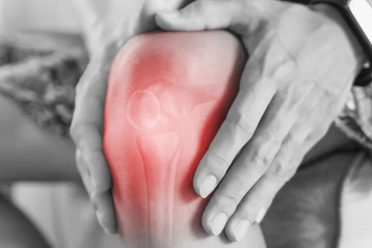 Arthritis project