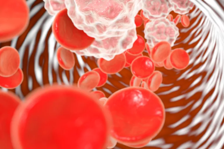 Center for Inflammation Research