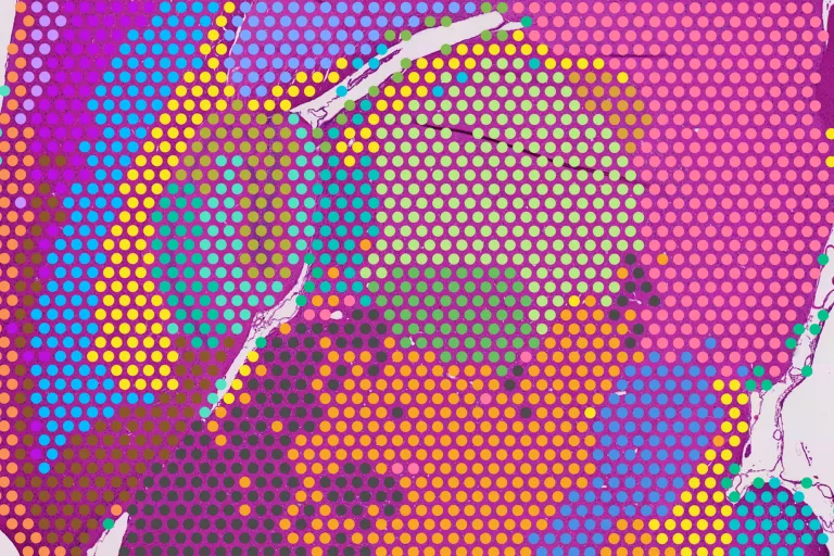 spatial_transcriptomics