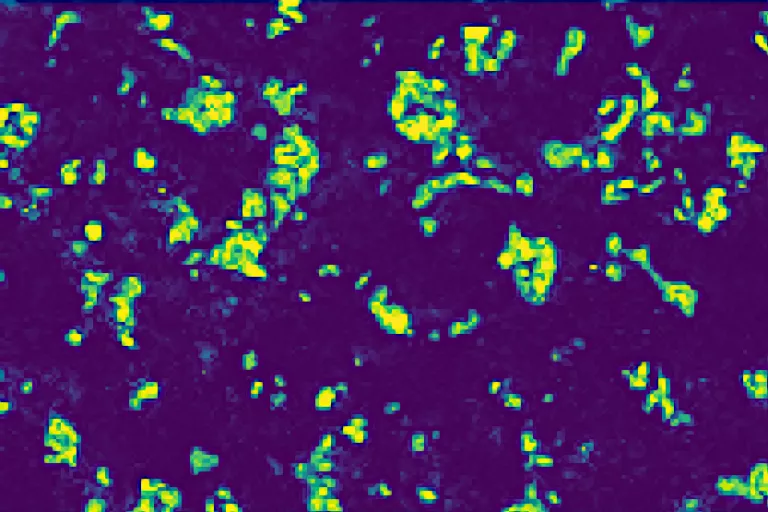 spatial_metabolomics