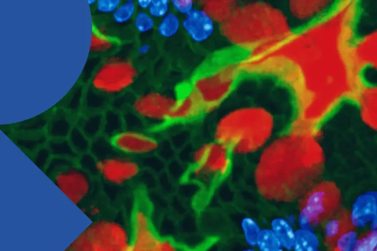 Banner Conference "Mucins in health and disease"
