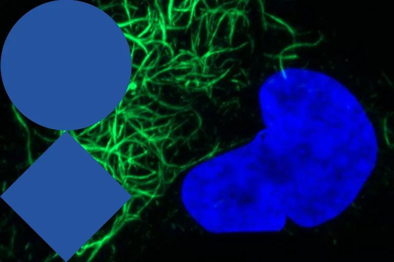 The Leuven Protein Aggregation Meeting (3rd edition)