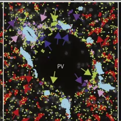Spatial_liver_map